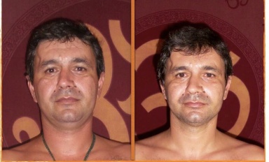 weight loss-01 weight loss-01