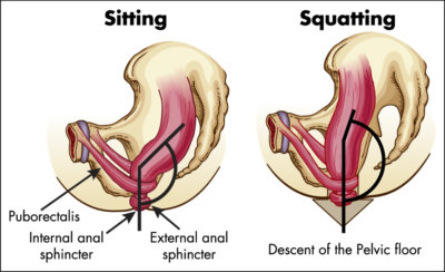 analrectal-angle-comparison